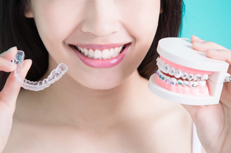 Girl with straight white teeth smiling while holding up Invisalign and braces teeth model.